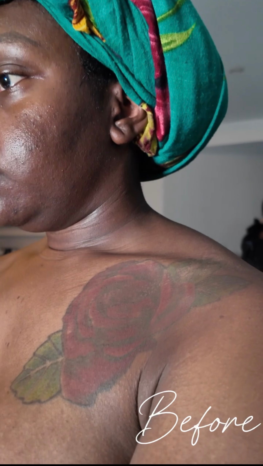 Colored rose shoulder tattoo before makeup coverage